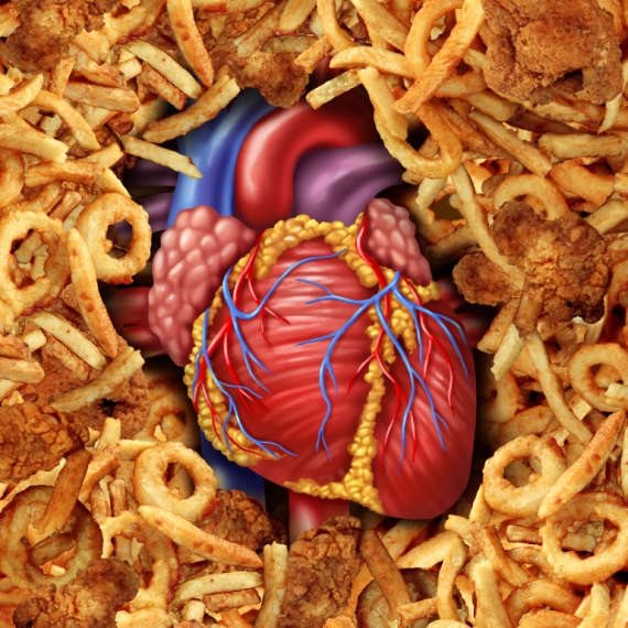 כולסטרול גבוה