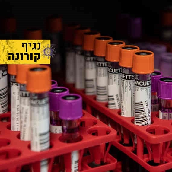 בדיקות דם מעבדה איטליה - וירוס הקורונה